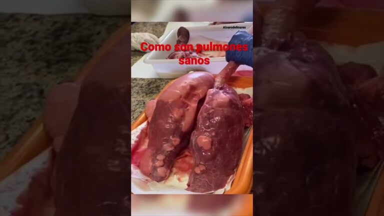 Muestra en TikTok cómo se le inflamó la frente tras exponerse al sol